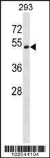 Anti-DKK3 Rabbit Polyclonal Antibody (FITC (Fluorescein))