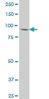 Anti-FBXO30 Mouse Polyclonal Antibody