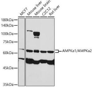 Western blot analysis of extracts of various cell lines, using Anti-AMPK alpha 1 +AMPK alpha 2 Antibody (A93304) at 1:1000 dilution