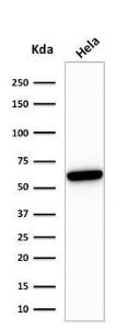 Anti-HSP60 antibody