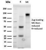 Antibody anti-MBD3 pcrp-MBD3-1C4 100 µg