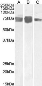 Anti-MCAM Antibody (A85268) (03 µg/ml) staining of Human Heart (A), Placenta (B) and Umbilical Cord (C) lysate (35 µg protein in RIPA buffer) Primary incubation was 1 hour Detected by chemiluminescence