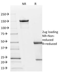 SDS-PAGE analysis of Anti-p21 Antibody [AC8] under non-reduced and reduced conditions; showing intact IgG and intact heavy and light chains, respectively. SDS-PAGE analysis confirms the integrity and purity of the antibody.