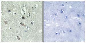 Immunohistochemical analysis of paraffin-embedded human brain using Anti-HBP1 (phospho Ser402) Antibody 1:100 (4°C overnight). The right hand panel represents a negative control, where the antibody was pre-incubated with the immunising peptide.