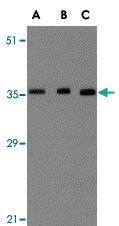 Anti-BRCC3 Rabbit Polyclonal Antibody