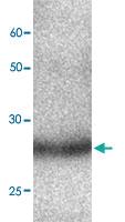 Anti-SERPINB4 Mouse Monoclonal Antibody [clone: 8w784]