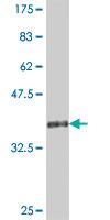 Anti-TRIM5 Mouse Polyclonal Antibody