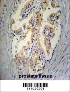 Anti-STC2 Rabbit Polyclonal Antibody (HRP (Horseradish Peroxidase))