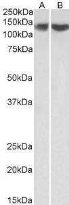 Anti-REST Antibody (A83621) (03 µg/ml) staining of HEK293 (A) and HeLa (B) lysate (35 µg protein in RIPA buffer) Primary incubation was 1 hour Detected by chemiluminescence