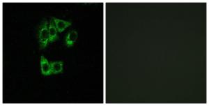 Immunofluorescence analysis of A549 cells using Anti-GIMAP2 Antibody. The right hand panel represents a negative control, where the antibody was pre-incubated with the immunising peptide