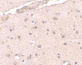 Anti-BRCC3 Rabbit Polyclonal Antibody