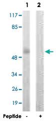 Anti-DAPK3 Rabbit Polyclonal Antibody