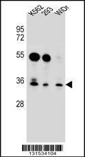 Anti-GLIPR1L2 Rabbit Polyclonal Antibody (APC (Allophycocyanin))