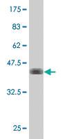 Anti-CDH2 Mouse Polyclonal Antibody