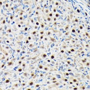 Anti-GTPBP4/NOG1 antibody