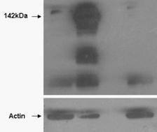 HEK293 overexpressing TANK1 (lane 2) and TANK2 (lane 4) and probed with Anti-TNKS Antibody (A85270) (mock transfection in first lane)