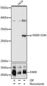 Western blot analysis of extracts of HeLa cells, using Anti-FADD (phospho Ser194) Antibody (A305369) at 1:1000 dilution or FADD antibody (A5819)