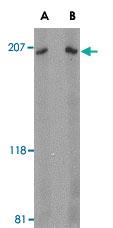 Anti-ARHGEF17 Rabbit Polyclonal Antibody