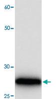 Anti-TNNI3 Mouse Monoclonal Antibody [clone: 9g054]