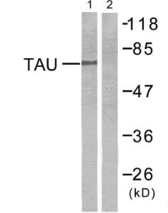 Western blot analysis of lysates from mouse brain using Anti-Tau Antibody. The right hand lane represents a negative control, where the antibody is blocked by the immunising peptide