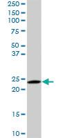 Anti-RAB6A Mouse Monoclonal Antibody [clone: 3G3]