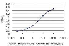 Anti-PALM2 Mouse Monoclonal Antibody [clone: 1A8]