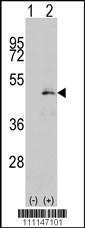 Anti-MAP2K1 Rabbit Polyclonal Antibody (AP (Alkaline Phosphatase))