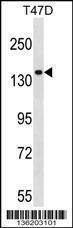 Anti-MYO1E Rabbit Polyclonal Antibody (AP (Alkaline Phosphatase))