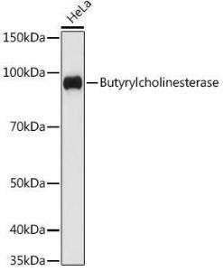 Western blot analysis of extracts of HeLa cells, using Anti-Butyrylcholinesterase Antibody [ARC1328] (A305370) at 1:1,000 dilution. The secondary antibody was Goat Anti-Rabbit IgG H&L Antibody (HRP) at 1:10,000 dilution.