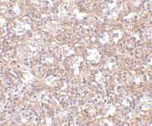 Anti-ARHGEF17 Rabbit Polyclonal Antibody