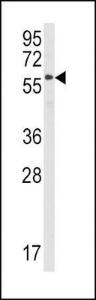 Anti-STAM Rabbit Polyclonal Antibody (HRP (Horseradish Peroxidase))