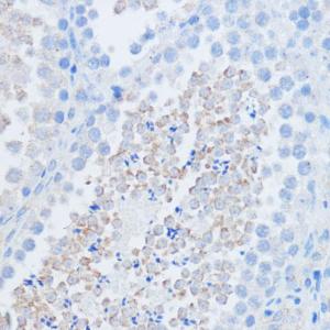 Immunohistochemistry analysis of paraffin-embedded mouse testis using Anti-RALGDS Antibody (A93309) at a dilution of 1:100 (40X lens). Perform microwave antigen retrieval with 10 mM PBS buffer pH 7.2 before commencing with IHC staining protocol