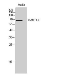 Western blot analysis of HuvEc cells using Anti-CAMKK2 Antibody