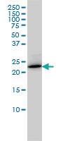 Anti-RAB6A Mouse Monoclonal Antibody [clone: 3G3]