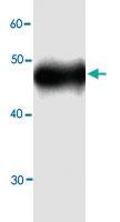 Anti-ALDOB Mouse Monoclonal Antibody [clone: 5g898]