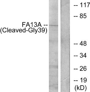 Western blot analysis of lysates from Jurkat cells, treated with etoposide 25uM 24h using Anti-FA13A (cleaved Gly39) Antibody. The right hand lane represents a negative control, where the antibody is blocked by the immunising peptide