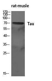 Western blot analysis of various cells using Anti-Tau Antibody