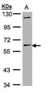 Anti-MRE11A Rabbit Polyclonal Antibody