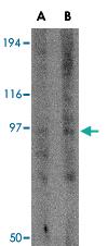 Anti-GRIK3 Rabbit Polyclonal Antibody