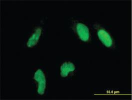 Anti-GLTSCR2 Mouse Monoclonal Antibody [clone: 5A8]