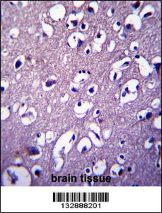 Anti-DCTN4 Rabbit Polyclonal Antibody (PE (Phycoerythrin))