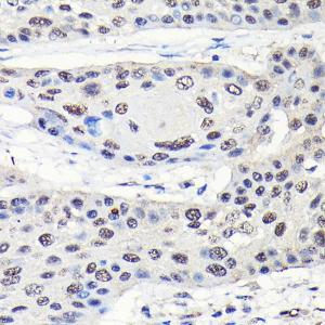 Anti-GTPBP4/NOG1 antibody