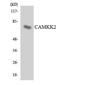 Western blot analysis of the lysates from HeLa cells using Anti-CAMKK2 Antibody