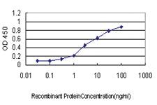 Anti-GCK Mouse Monoclonal Antibody [clone: 3C7]