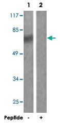 Anti-DDX3X Rabbit Polyclonal Antibody