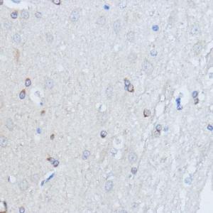 Immunohistochemistry analysis of paraffin-embedded rat brain using Anti-RALGDS Antibody (A93309) at a dilution of 1:100 (40X lens). Perform microwave antigen retrieval with 10 mM PBS buffer pH 7.2 before commencing with IHC staining protocol