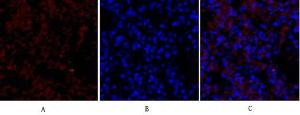 Immunofluorescence analysis of rat lung tissue using Anti-VEGFR2 Antibody (red) at 1:200 (4°C overnight). Cy3 labelled secondary antibody was used at 1:300 (RT 50min). Panel A: Target. Panel B: DAPI. Panel C: Merge.