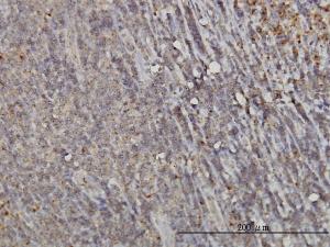 Anti-RAB6A Mouse Monoclonal Antibody [clone: 3G3]