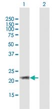 Anti-ARL6 Mouse Polyclonal Antibody