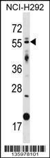 Anti-GLIS2 Rabbit Polyclonal Antibody (Biotin)